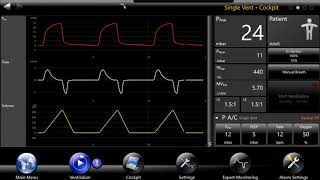 bellavista™ Ventilator Backup Ventilation [upl. by Tada]