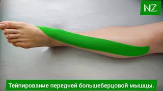 Тейпирование передней большеберцовой мышцы Taping of the anterior tibial muscle [upl. by Scammon]