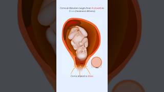 Effacement and Dilatation 🤔fetus share foryou [upl. by Ziegler]