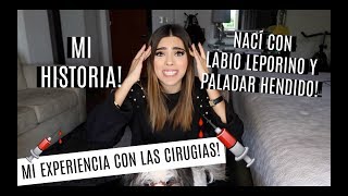 Mi historia con labio leporino Parte 1 ¿Qué es el labio leporino y el paladar hendido [upl. by Anitnemelc]