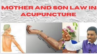 MOTHER AND SON LAW IN ACUPUNCTURE [upl. by Shere]