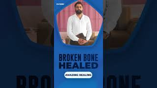 Broken Bone Healed  Amazing Healing Testimony  AmritSandhuMinistries  reels [upl. by Cathee]