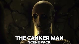 The Canker Man  Before I Wake  Scene Pack [upl. by Blader]