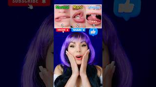 TrendVideoShorts جعل خيار واحد فقط shorts viral tiktok natalishik p411 [upl. by Eniluqaj]