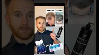 Top 3 hair loss solutions 2024 menshairloss haircare [upl. by Oicanata]