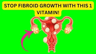 STOP Fibroid Growth with This 1 Vitamin [upl. by Nived803]