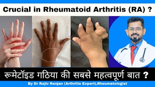 रूमेटॉइड गठिया में सबसे महत्वपूर्ण   Crucial in Rheumatoid Arthritis Treatment [upl. by Erait759]