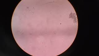 Normozoospermia amp Oligozoospermia semen slide under the microscopy 40x [upl. by Fosque]