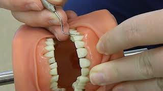 Periodontal Probe Technique [upl. by Rebba]