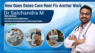 How Does Osteo Care Root Fix Anchor WorkDr Sai Chandra MBBS DNB Ortho Hyderabad [upl. by Artimid]