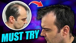 5 Weird but Effective Ways to Stop Hair Loss [upl. by Bokaj976]