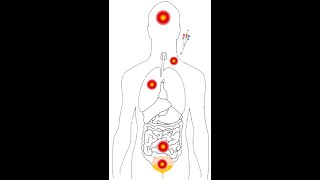 Empirical Antibiotic Use Overviewalgorithms for ESBL CRE MDR and XDR [upl. by Kevin]