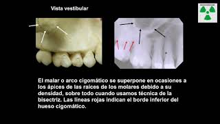 Anatomía radiológica Maxilar y mandibular [upl. by Minette]