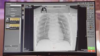 CARESTREAM Image Suite Software with DRXDetector Xray Imaging [upl. by Shaum]