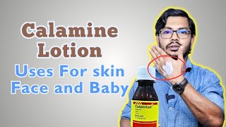 Calamine Lotion  ক্যালামাইন লোশন ব্যবহারের নিয়ম [upl. by Strander]