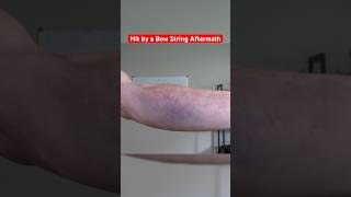 Creating the WORST Bow String Injury funny memes science [upl. by Alexandria912]