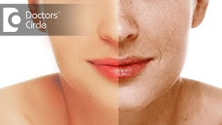 What causes facial hyperpigmentation  Dr Priyanka Dasari Reddy [upl. by Ardine815]