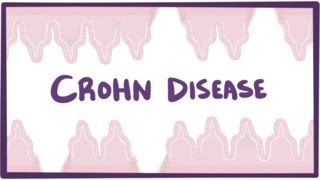 Crohns disease Crohn disease  causes symptoms amp pathology [upl. by Aniral]