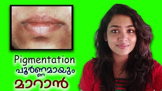 How to PERMANENTLY Remove Dark Black patchesDark SpotsHyper pigmentation around Mouth amp UpperLips [upl. by Nannahs]