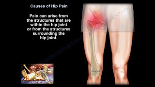 hip pain causes diagnosis and treatment [upl. by Elime]