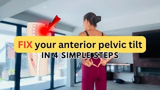 Fix your anterior pelvic tilt in 4 simple steps [upl. by Lipcombe661]