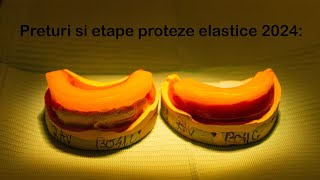 Preturi proteze elastice si etape in 2024 Raspund la intrebarile dvs [upl. by Ativahs389]