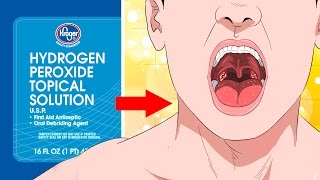 10 Surprising Uses For Hydrogen Peroxide YOU NEED TO KNOW [upl. by Crispin394]