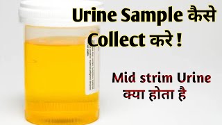 mid stream urine collection procedure II urine specimen collection procedure [upl. by Negiam]