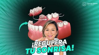 ¡Descubre el Secreto de la Prótesis Dental Removible [upl. by Ardnoed]