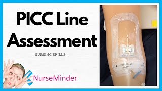 PICC Line Assessment Nursing Skills [upl. by Oppen546]