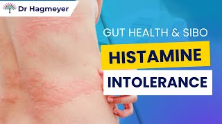 Histamine Intolerance Gut Health amp SIBO Unraveling the Connection Between Your Gut Histamine [upl. by Eustache345]