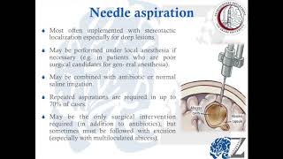 CNS Infection 3 Brain Abscess 3 خُراج بالمخ [upl. by Nirrej]