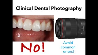 Dental Photography 3 Tips for Excellent Anterior Images HD 1080p [upl. by Travers63]