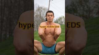 Hypermobile EDS whealth stayflexy [upl. by Merrie591]