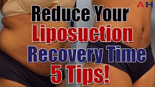 Liposuction Recovery Care  Reduce Your Liposuction Surgery Recovery Time  5 Tips [upl. by Borman]