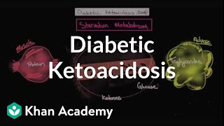 Acute complications of diabetes  Diabetic ketoacidosis  NCLEXRN  Khan Academy [upl. by Salomon]