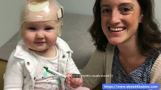 Newborn Misshapen Head Positional Plagiocephaly Treatment [upl. by Gerardo234]