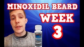 Monoxidil Beard  Week 3  Minoxidil 5 for Beard Growth  Facialfuzzfridays [upl. by Irihs]