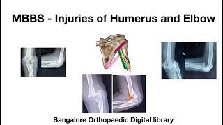 MBBS  Humerus and Elbow injuries [upl. by Llacam482]