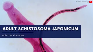 Adult Schistosoma japonicum under the microscope [upl. by Langille]