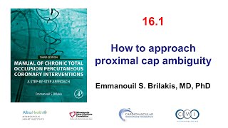 Video 161 Manual of CTO PCI  Proximal cap ambiguity [upl. by Htessil101]