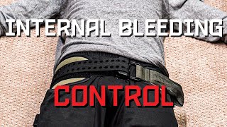 Control Internal Bleeding Pelvic Binder Application [upl. by Irmine]