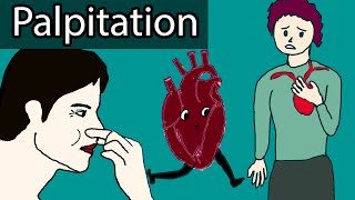 Heart Palpitations  Causes When to worry about heart palpitations [upl. by Atoked]