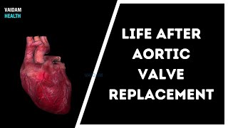 Life After Aortic Valve Replacement [upl. by Liauqram]