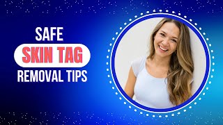 Safe SkinTag Removal Tips [upl. by Ellevehc]