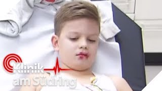 Kinder 8 essen Rattengift Jetzt droht die innere Verblutung  Klinik am Südring  SAT1 TV [upl. by Senn]