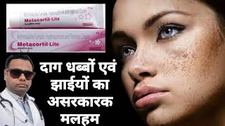 Ointment for melasma। Metacortil ointment review Hydroquinone Tretinoin amp Mometasone cream। uses। [upl. by Suirtemid645]