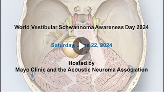 Vestibular schwannoma Molecularlyinformed therapies [upl. by Uriah37]