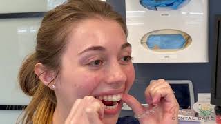 Getting your Invisalign trays in and out [upl. by Brainard]