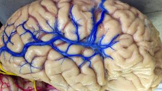 VEINS OF THE BRAIN  INJECTED WITH SILICONE COLOR BLUE [upl. by Yllus248]